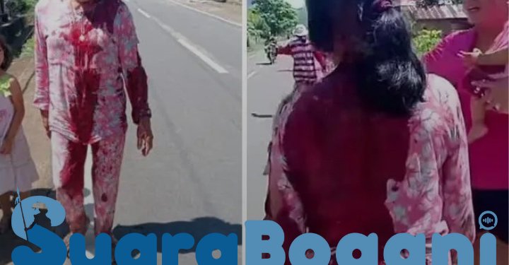 Seorang Ibu Warga Desa Tungoi Dua Dibacok Tetangga, Pelaku Diduga Mabuk