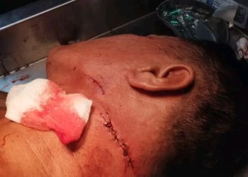 Kasus Penganiayaan Sahrin Molok Mandek, Korban Pertanyakan Penanganan Polisi