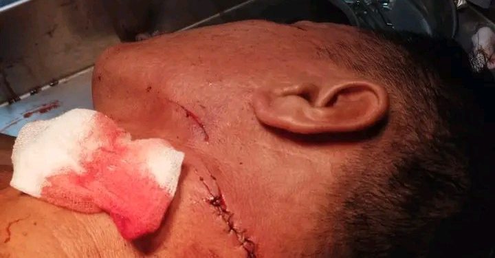 Kasus Penganiayaan Sahrin Molok Mandek, Korban Pertanyakan Penanganan Polisi